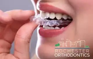 Top 5 Orthodontic Problems in Adults and Expert Solutions